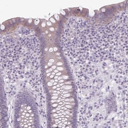 NHSL2 Antibody, Novus Biologicals:Antibodies:Primary Antibodies